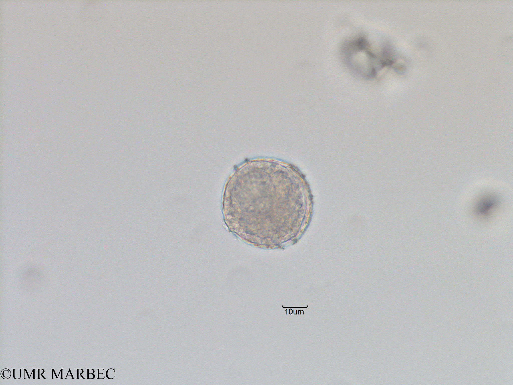 phyto/Bizerte/bizerte_bay/RISCO November 2015/Protoceratium spinulosum (Baie_T5-ACW1-Protoceratium reticulatum-8).tif(copy).jpg